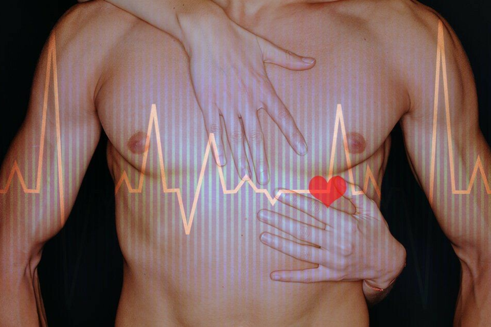 Sex and Heart Attacks